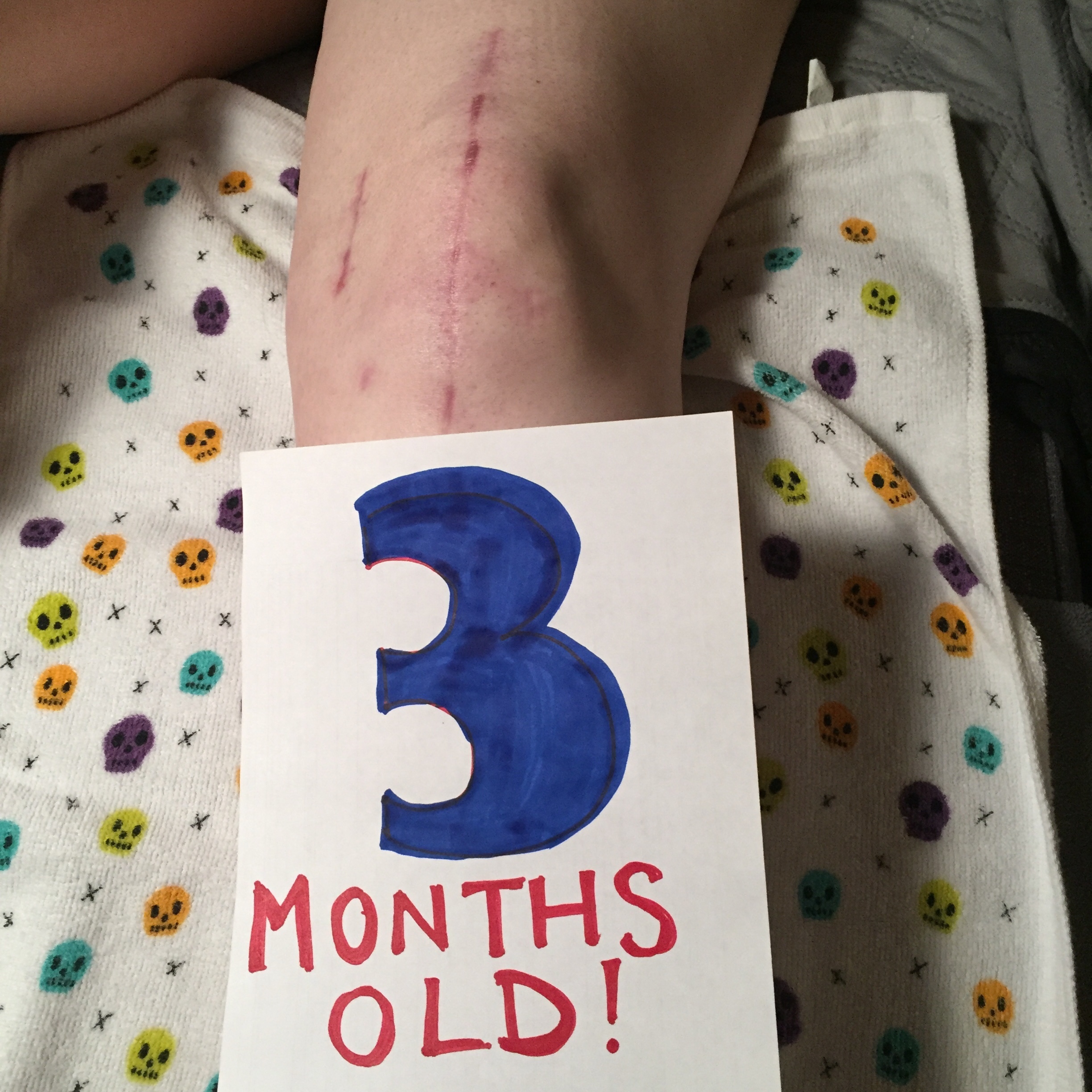 Three Months Old