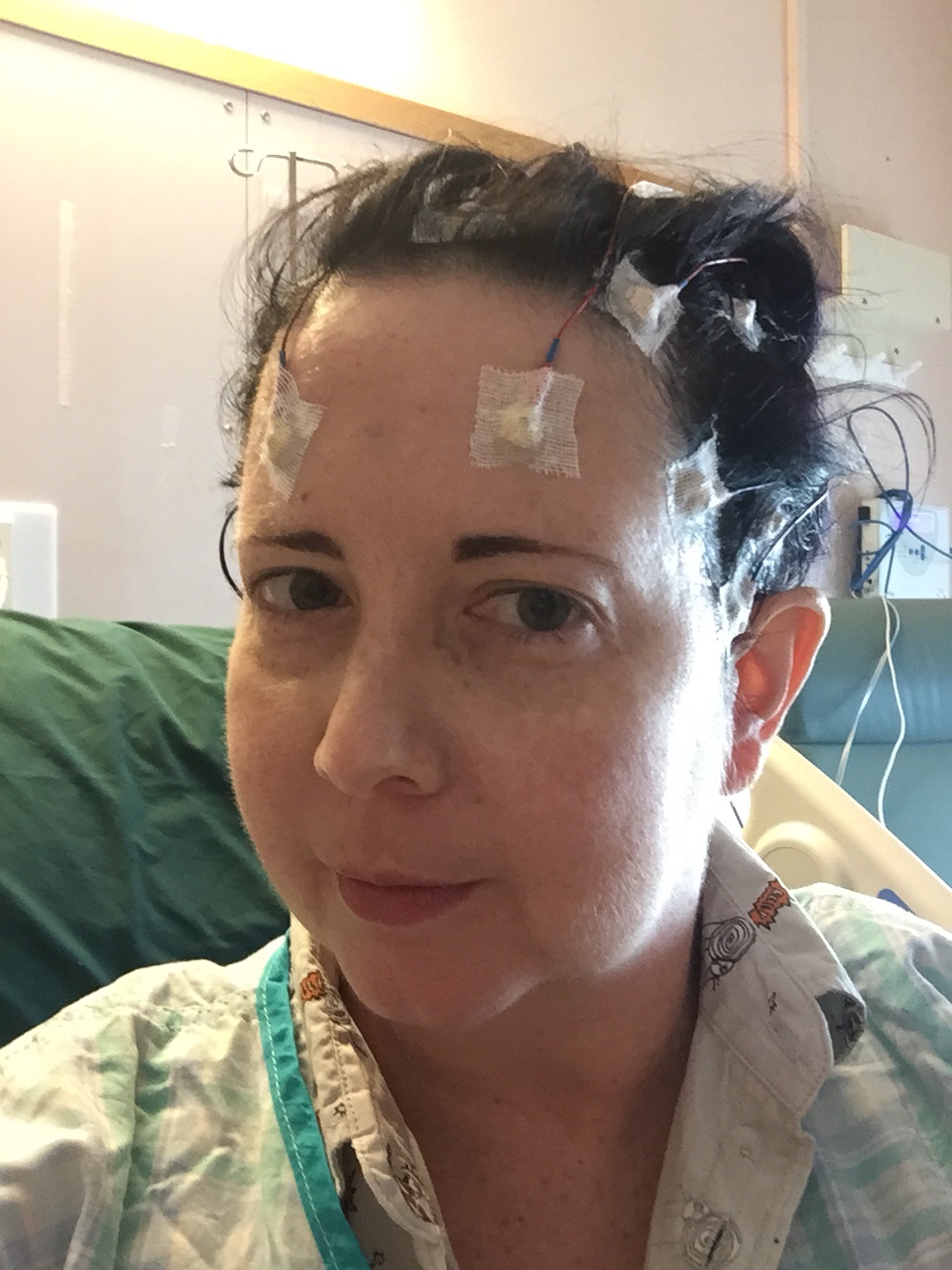 Video EEG Update